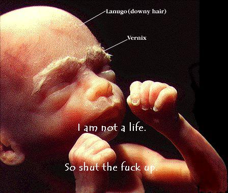 fetus.jpg